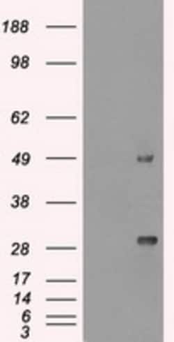 OriGene Ki67 (MKI67) Mouse Monoclonal Antibody [Clone ID: OTI3D11], Quantity: