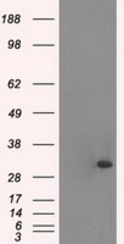 OriGene Cardiac Troponin I (TNNI3) Mouse Monoclonal Antibody [Clone ID: OTI4A3]