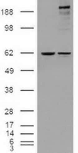 OriGene NOTCH1 Mouse Monoclonal Antibody [Clone ID: OTI4C9], Quantity: