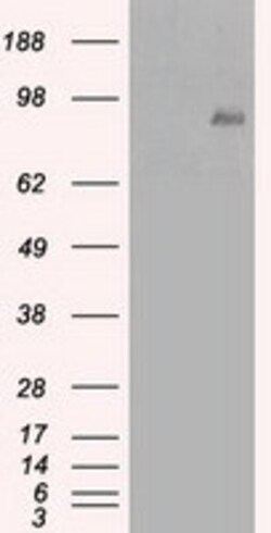 OriGene beta Catenin (CTNNB1) Mouse Monoclonal Antibody [Clone ID: OTI3G4],