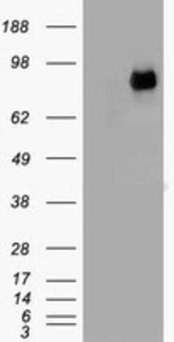 OriGene beta Catenin (CTNNB1) Mouse Monoclonal Antibody [Clone ID: OTI2D11],