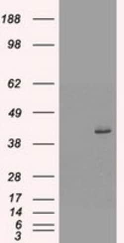 OriGene Cytokeratin 19 (KRT19) Mouse Monoclonal Antibody [Clone ID: OTI3A11],