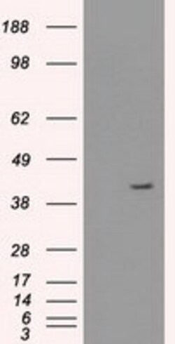 OriGene Cytokeratin 19 (KRT19) Mouse Monoclonal Antibody [Clone ID: OTI4E12],