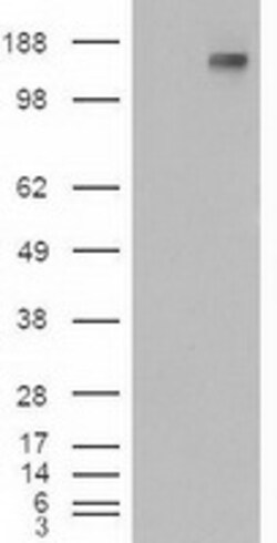 OriGene PTCH1 Mouse Monoclonal Antibody [Clone ID: OTI3C2]