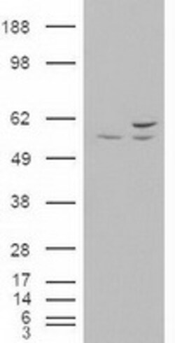 OriGene AKT3 Mouse Monoclonal Antibody [Clone ID: OTI9H8], Quantity: Each