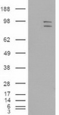 OriGene MAPK6 Mouse Monoclonal Antibody [Clone ID: OTI5E1], Quantity: Each