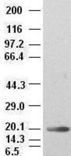 OriGene IL6 Mouse Monoclonal Antibody [Clone ID: OTI2G3], Quantity: Each