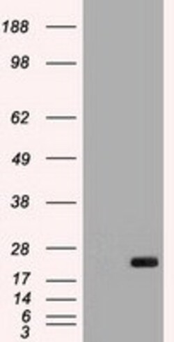 OriGene IL6 Mouse Monoclonal Antibody [Clone ID: OTI2C9], Quantity: Each