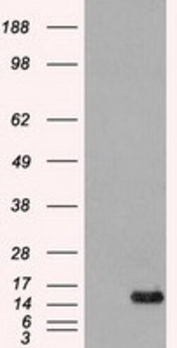 OriGene FGF1 Mouse Monoclonal Antibody [Clone ID: OTI4D2], Quantity: Each