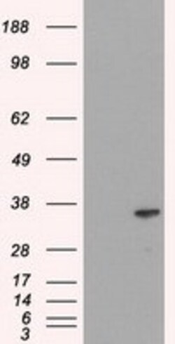 OriGene ICAD (DFFA) Mouse Monoclonal Antibody [Clone ID: OTI3F12], Quantity: