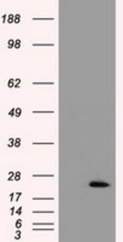 OriGene&nbsp;Cardiac Troponin I (TNNI3) Mouse Monoclonal Antibody [Clone ID: OTI4E5]