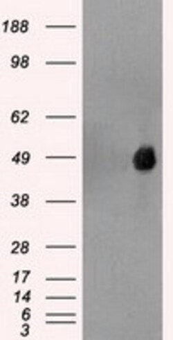 OriGene FOXA1 Mouse Monoclonal Antibody [Clone ID: OTI3C1], Quantity: Each