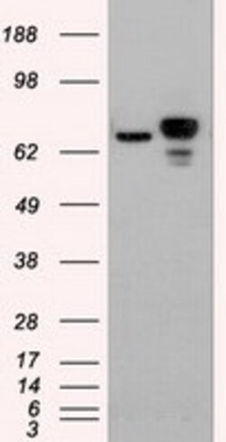 OriGene beta Catenin (CTNNB1) Mouse Monoclonal Antibody [Clone ID: OTI2H3],