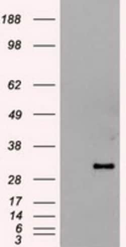 OriGene&nbsp;Hex (HHEX) Mouse Monoclonal Antibody [Clone ID: OTI3C4]