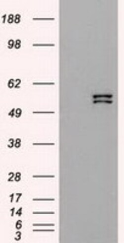 OriGene Cytokeratin 8 (KRT8) Mouse Monoclonal Antibody [Clone ID: OTI2E4],
