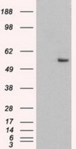 OriGene Cytokeratin 8 (KRT8) Mouse Monoclonal Antibody [Clone ID: OTI1B9],