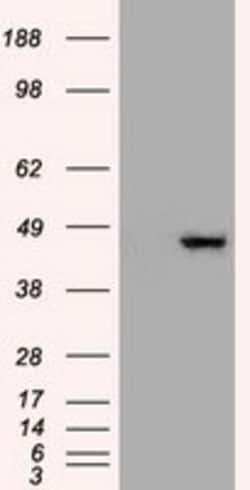 OriGene Cytokeratin 19 (KRT19) Mouse Monoclonal Antibody [Clone ID: OTI2F8],