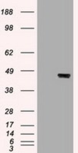 OriGene Cytokeratin 19 (KRT19) Mouse Monoclonal Antibody [Clone ID: OTI5D1],