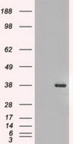 OriGene FGF2 Mouse Monoclonal Antibody [Clone ID: OTI2H11], Quantity: Each
