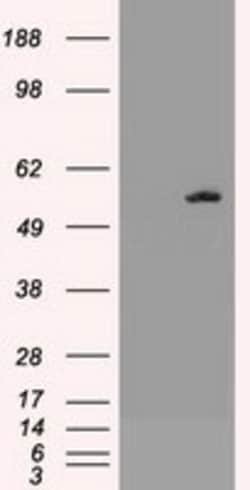 OriGene AKT3 Mouse Monoclonal Antibody [Clone ID: OTI9B2], Quantity: Each