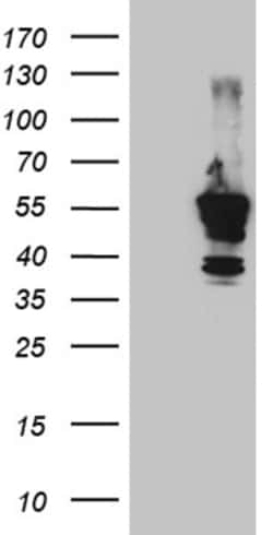 OriGene Mouse monoclonal tdTomato antibody, Clone OTI4B3, Quantity: Each