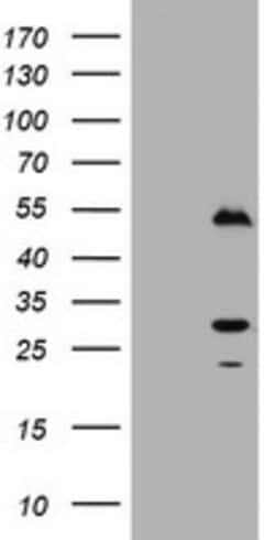 OriGene Mouse Monoclonal Timer Antibody, clone OTI3H3