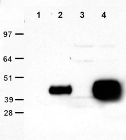 OriGene&nbsp;Clone OTI4C5, Anti-DDK (FLAG) Monoclonal Antibody, Agarose Beads