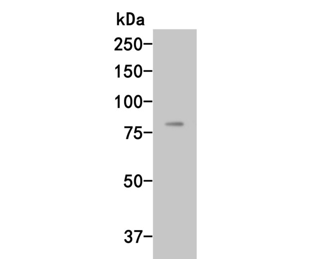 HUABIO RESEARCH INC Anti Complement Factor B Antibody Quantity Each Huabio research inc anti complement factor b antibody quantity each
