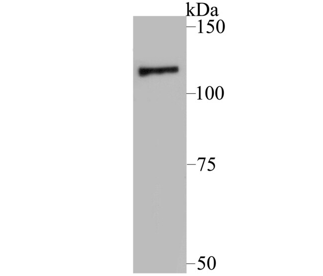 HUABIO RESEARCH INC Anti-Raptor Antibody, Quantity: Each of 1 | Fisher ...