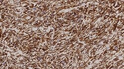 Leica Biosystems 1ml NCL-L-VIM-572, Quantity: Each of 1
