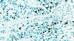 Leica Biosystems 1ml NCL-L-TOPOIIA, Quantity: Each of 1