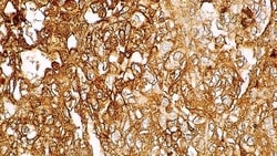 Leica Biosystems 7ml AFP Bond RTU Primary, Quantity: Each of 1