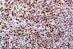 Leica Biosystems 7ML SOX-11 (MRQ-58 Mab) 'CM', Quantity: Each of 1