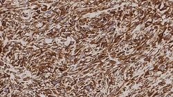 Leica Biosystems 7ml Vimentin Bond RTU Primary, Quantity: Each of 1