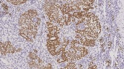 Leica Biosystems 7ml Wilms Tumor Bond RTU Prim, Quantity: Each of 1