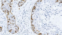 Leica Biosystems 7ml Cytokeratin 5 Bond RTU Pri, Quantity: Each of 1