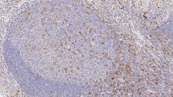 Leica Biosystems 7mL TIM-3 (EPR22241) BOND RTU, Quantity: Each of 1