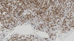 Leica Biosystems 7ml CD1a Bond RTU Primary, Quantity: Each of 1