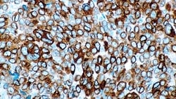 Leica Biosystems 7ml Melan A Bond RTU Primary, Quantity: Each of 1