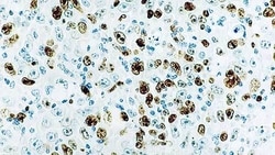 Leica Biosystems 7ml Ki67 (K2) Bond RTU Primary, Quantity: Each of 1
