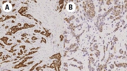 Leica Biosystems 7ml Estrogen Receptor Bond RTU, Quantity: Each of 1