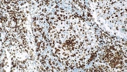 Leica Biosystems 7ml CD45RO Bond RTU Primary, Quantity: Each of 1