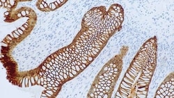 Leica Biosystems 7ml CK8/18 Bond RTU Primary, Quantity: Each of 1
