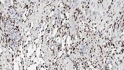 Leica Biosystems 7ml Herpesvirus(Type 8) (13B10, Quantity: Each of 1