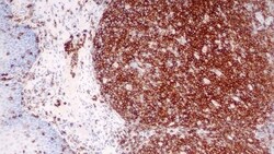 Leica Biosystems 7ml CD45 Bond RTU Primary, Quantity: Each of 1