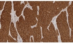 Leica Biosystems 7mL S-100 (EP32) BOND RTU Prim, Quantity: Each of 1