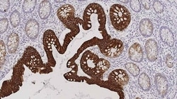 Leica Biosystems 7ml Cytokeratin 20 Bond RTU Pr, Quantity: Each of 1