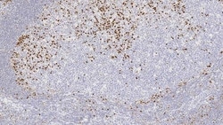 Leica Biosystems 1ml NCL-L-MUM1, Quantity: Each of 1