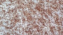 Leica Biosystems 1ml NCL-L-MT1, Quantity: Each of 1