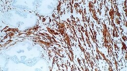 Leica Biosystems 1ml NCL-MHCf, Quantity: Each of 1